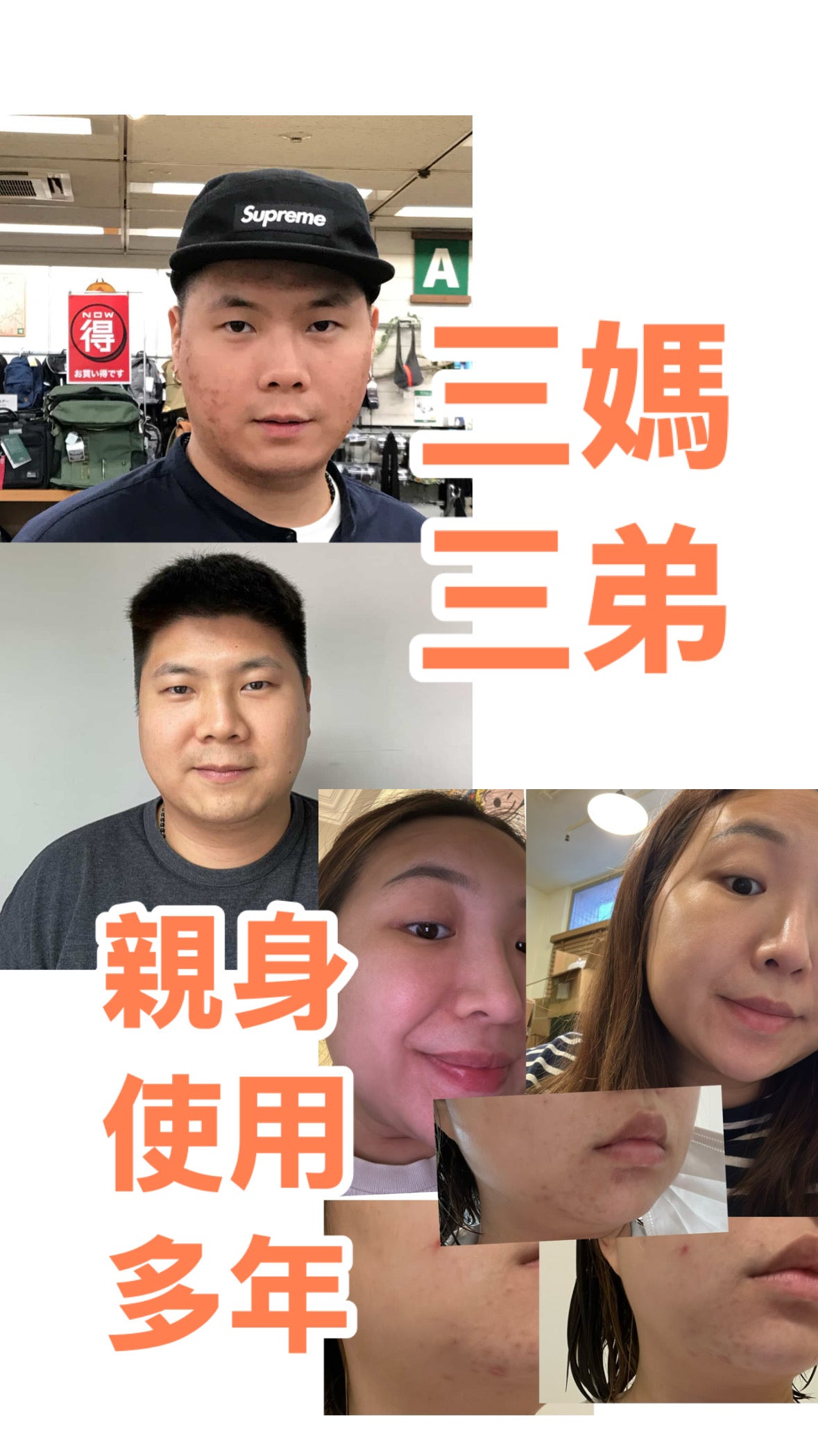 【 多買多送新優惠 】MAMAMA EXOCARE MASK 🇯🇵外泌體面膜( 1盒5枚 )